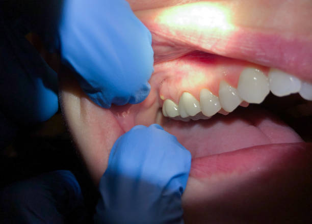 Best Emergency Dental Care for Trauma or Injury in North Richland Hills, TX